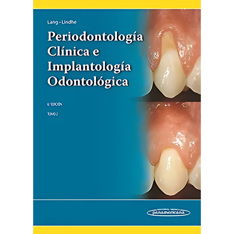 PERIODONTOLOGIA CLINICA 6A Ed TOMO II