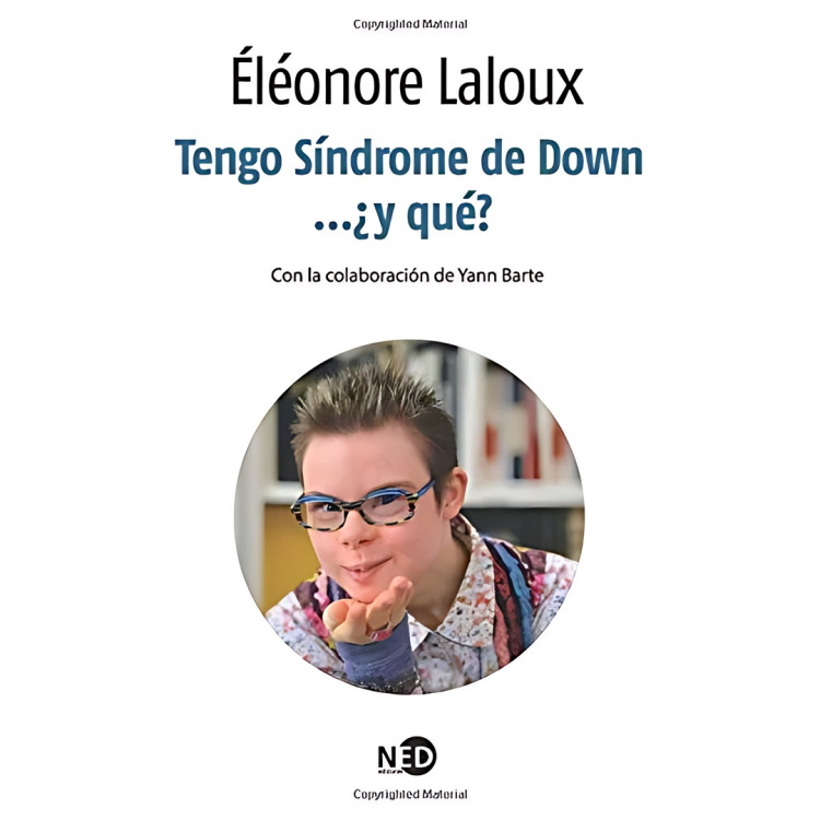 TENGO SINDROME DE DOWN Y QUE