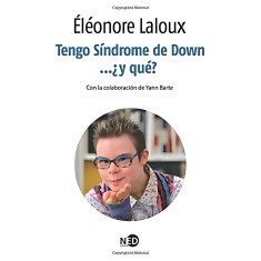 TENGO SINDROME DE DOWN Y QUE